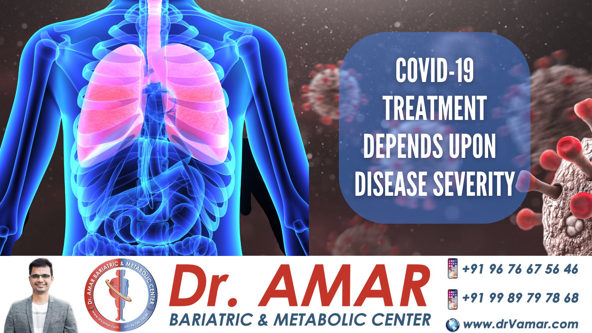 COVID-19 is treated based on disease severity