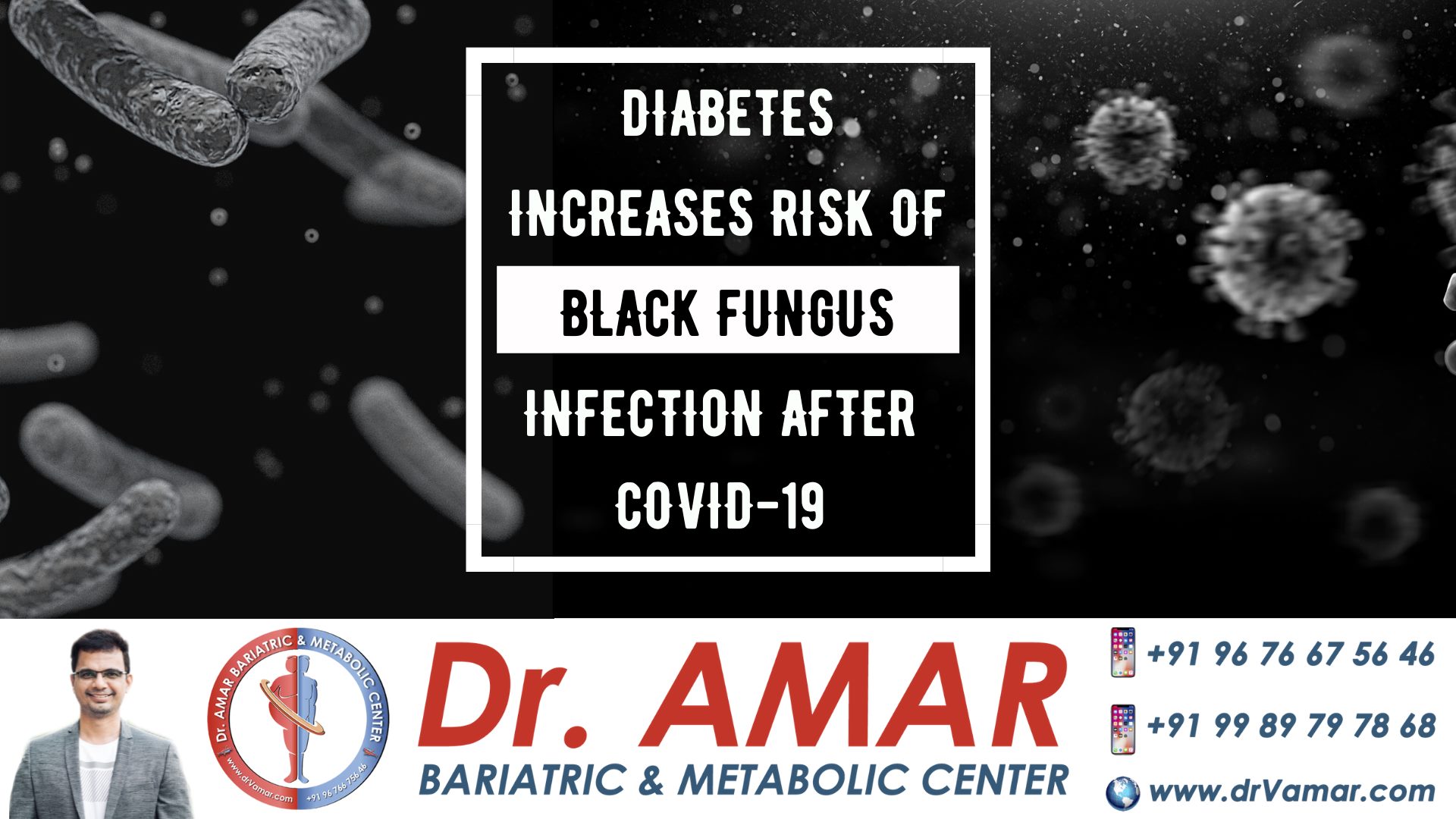 Diabetes increases risk of black fungus infection after Covid-19