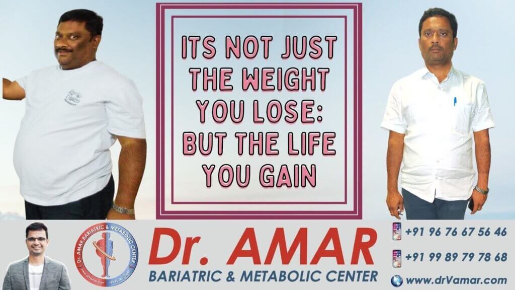 Mr. Ranadheer Reddy Review on Weight Loss Surgery