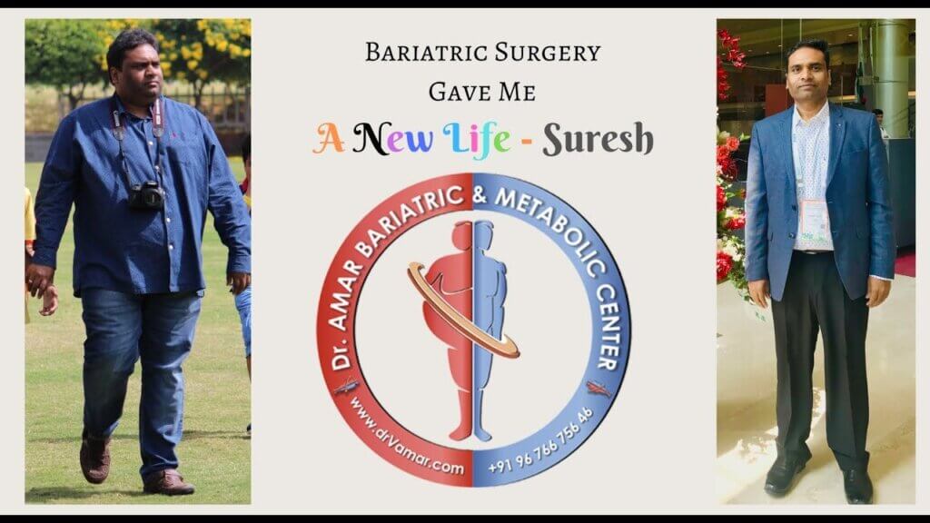Naga Suresh – Bariatric Surgery Review – Dr. V. Amar Bariatric and Metabolic Center