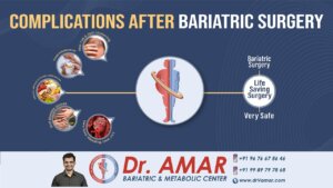 Complications after Bariatric and Metabolic Surgeries – Dr. V. Amar