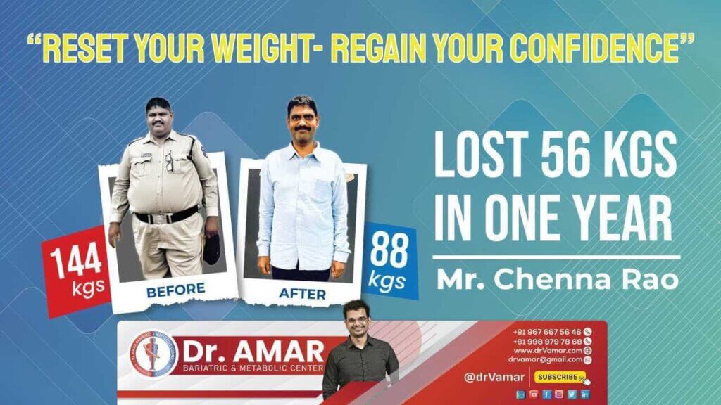 Reset your Weight – Regain your Confidence – Mr. Chenna Rao Weight Loss Surgery Review – Dr. V. Amar