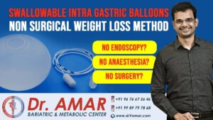 Swallowable Intra Gastric Balloons – How far claims are true ? – Dr. V. Amar – Hyderabad